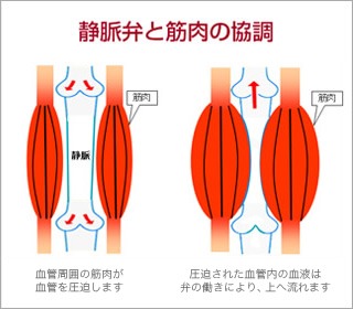 下肢静脈瘤について