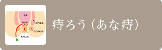 痔ろう（うみ痔）