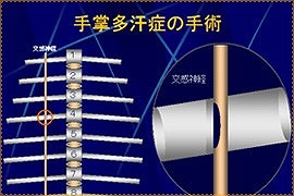 副作用の発生を最小限にするために